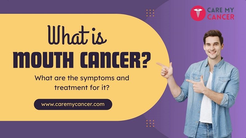 What is mouth cancer? What are the symptoms and treatment for it?