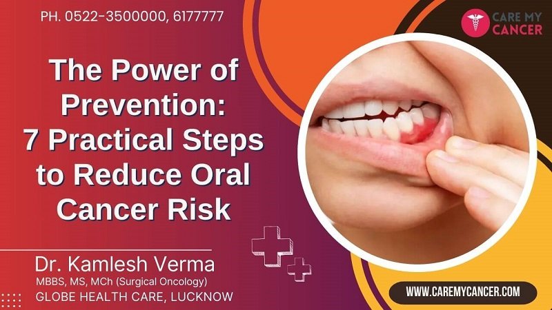 7 Practical Steps to Reduce Oral Cancer Risk